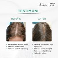Gambar DAYTOPIA - Green Angelica Hair Shampoo untuk Rambut Lepek Berketombe dan Rontok dari Daytopia Beauty undefined 4 Tokopedia