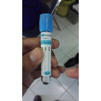 Gambar Tabung Sodium Citrate 1.8ml GP / Sodium CItrat 3.2% 1.8ml VIDELAB / Blood Vacuum Tube 1,8 ml VIDELAB dari NexMedis undefined 1 Tokopedia