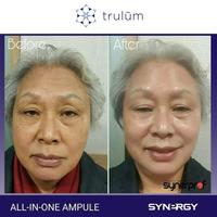 Gambar TheFace- Pembersih Make Up Tebaik Tokopedia By Trùlûm dari Ambarwulanria17 undefined 4 Tokopedia