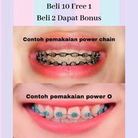 Gambar Behel lepas pasang murah ATAS / BAWAH dari tokobalabal0005 undefined 1 Tokopedia