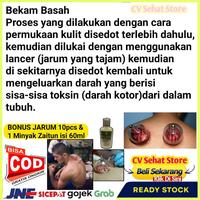 Gambar Alat Bekam Komplit Full Set 6 Kop Dan Pen Lancing Device Becam Autoklik Terapi Tradisional Vaccum cup Badan Bekam Basah Kering Therapi Manual Kop Untuk Masuk Angin Tubuh Pegal Linu Lengkap Dengan Pen Pena Lancet Lancing Device Penembak Jarum Paket Bekam dari Dinda teteh undefined 5 Tokopedia