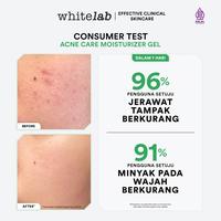 Gambar Whitelab Acne Care Moisturizer Gel - Pelembap Kulit Wajah Untuk Mengurangi Dan Meredakan Jerawat Pagi Malam Dengan Bha, Mugwort & Tea Tree [Bpom] Berkualitas dari Anertava undefined 2 Tokopedia
