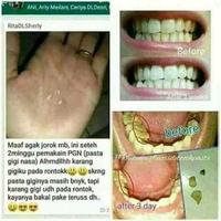 Gambar Umah Rempah Pasta Gigi Nasa Penghilang Dan Perontok Karang Gigi PASTA GIGI / Pemutih Gigi / Obat Sakit Gigi Meredakan Sakit Gigi dari SARNIAH MARKET undefined 1 Tokopedia