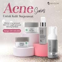 Gambar MS Glow Paket Acne | 4 item - Paket Perawatan Pencerah, Anti Jerawat dan Komedo, Cocok Untuk Kulit Berminyak dan Sensitif - FW Glow dari Farma Loca Store undefined 3 Tokopedia
