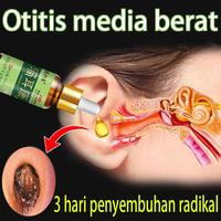 Gambar 【100% Original】Obat Paling Ampuh Telinga Bernanah Obat Telinga Sakit 30ML Obat Tetes Telinga Bernanah,Obat Tetes Telinga Berair,Sakit Telinga,Kuping Sakit, Infeksi Telinga,Telinga Gatal,Menghilangkan kotoran dari telinga, Menyembuhkan masalah telinga dari NANDA_officiall undefined 1 Tokopedia