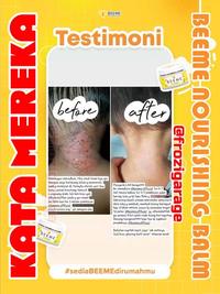Gambar BEEME NOURISHING BALM OBAT PELEMBAB WAJAH SALEP KRIM BEME BEMEE BEEMEE [GRES] dari yoyok grup undefined 2 Tokopedia