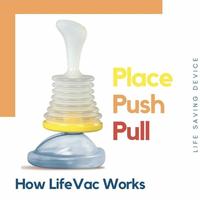 Gambar BOOM SALE LIFEVAC - CHOKING RESCUE DEVICE HOME KIT FOR ADULT AND dari tokoalatmedis undefined 4 Tokopedia