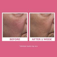 Gambar Peter Thomas Roth Vital-E Antioxidant Recovery Cream 50ml dari naturalbeautystuff undefined 4 Tokopedia