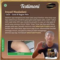 Gambar Obat Psoriasis Jamur Di Kulit Kepala Berkerak Kering Mengelupas dari elifastore undefined 3 Tokopedia