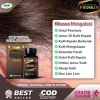 Gambar Obat Psoriasis Jamur Di Kulit Kepala Berkerak Kering Mengelupas dari elifastore undefined 1 Tokopedia
