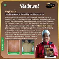 Gambar Obat Psoriasis Jamur Di Kulit Kepala Berkerak Kering Mengelupas dari elifastore undefined 4 Tokopedia