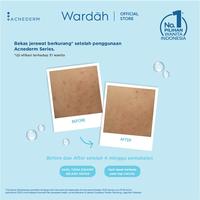 Gambar Wardah Acnederm Night Treatment Moisturizer 40 ml - Pelembab Wajah dari Roy storeee undefined 1 Tokopedia
