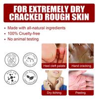 Gambar Exfoliating Feet Mask Sock Exfoliation Scrub for Feet Mask Remove Dead Skin Moisturizing Pedicure Anti Crack Foot Patch Spa dari rizalriyuo undefined 4 Tokopedia