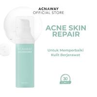 Gambar [[READY STOCK]] ACNAWAY DAILY MOISTURIZER PELEMBAB WAJAH ONLY FOR ACNE SKIN MENJAGA KELEMBABAN DAN MENGAHALUSKAN KULIT WITH KARELA + CERAMIDE COMPLEX + PROPOLIS 【BPOM】 [[BARANG TERLARIS]] dari Tilye undefined 2 Tokopedia