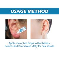 Gambar Terbaru, 30ml After Ear Piercing Care Solution Safe Formula Cleanser Disinfecting Nose Body Piercer dari geraldone undefined 4 Tokopedia