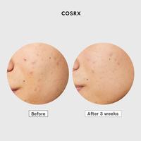 Gambar Diskon Cosrx Ac Collection Ultimate Spot Cream 30 Gr Ready dari marcellioshoop undefined 3 Tokopedia