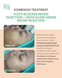 Gambar Zap Clinic Insta Glow Serum Meso Injection "Gratis Biaya Kirim" dari HAURAA_MART undefined 3 Tokopedia