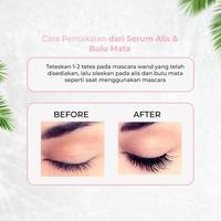 Gambar Serum Penumbuh Bulu Mata Dan Alis Growth Serum 100% Garansi Original - 1 pcs dari Oncare Official undefined 2 Tokopedia