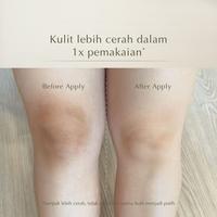Gambar Ready Gan Mossèru Aha 8%+Bha 2% Dead Skin Removal Body Toner | Angkat Set Kulit Mati | Bersihkan Pori | Mencerahkan Badan | Membantu Melembabkan Kulit Ready Gan dari Geek Beauty168 undefined 5 Tokopedia