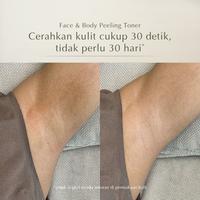 Gambar Ready Gan Mossèru Aha 8%+Bha 2% Dead Skin Removal Body Toner | Angkat Set Kulit Mati | Bersihkan Pori | Mencerahkan Badan | Membantu Melembabkan Kulit Ready Gan dari Geek Beauty168 undefined 1 Tokopedia