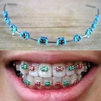 Gambar Product [BISA COD] Behel Gigi Lepas Pasang Murah Kawat Behel Warna Behel Atas Bawah Lepas Pasang Fashion Aneka Motif Cantik Barang berkwalitas dari alvianstorein undefined 5 Tokopedia