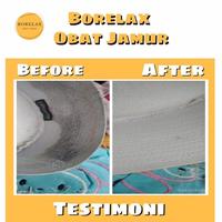 Gambar Borelax Penghilang Cimeting - Penghilang Noda Jamur Pakaian Bandel - Borelax Ampuh Penghilang Noda Jamur - Borelax Penghilang Noda Getah dari Enio undefined 3 Tokopedia