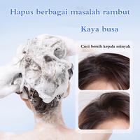 Gambar Obat Ketombe Sampo Ketombe Obat Ketombe Rambut Rontok Berkerak Sampo 300Ml Efesiensi Menghilangkan Ketombe/Cepat Anti Gatal/Memuluskan Rambut/Menjaga Kulit Kepala dari tangan ibu store undefined 4 Tokopedia