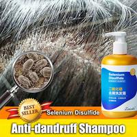 Gambar Obat Ketombe Sampo Ketombe Obat Ketombe Rambut Rontok Berkerak Sampo 300Ml Efesiensi Menghilangkan Ketombe/Cepat Anti Gatal/Memuluskan Rambut/Menjaga Kulit Kepala dari tangan ibu store undefined 1 Tokopedia