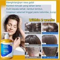 Gambar Obat Ketombe Sampo Ketombe Obat Ketombe Rambut Rontok Berkerak Sampo 300Ml Efesiensi Menghilangkan Ketombe/Cepat Anti Gatal/Memuluskan Rambut/Menjaga Kulit Kepala dari tangan ibu store undefined 2 Tokopedia