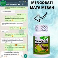 Gambar Obat Lemak Di Mata, Mata Berlemak Pterigium, Menghilangkan Selaput Lendir Pada Bola Mata - Keloreena dari storezynn undefined 2 Tokopedia