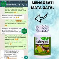 Gambar Obat Lemak Di Mata, Mata Berlemak Pterigium, Menghilangkan Selaput Lendir Pada Bola Mata - Keloreena dari storezynn undefined 5 Tokopedia