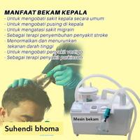 Gambar Mesin Terapi Bekam Kepala Tanpa Cukur dari ZAITUN masia el atlet undefined 1 Tokopedia