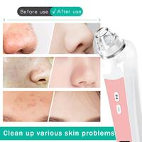 Gambar Electric Visual Blackhead Remover Vacuum Pore Cleaner Face Acne Pimple Extractions Tool with Camera 6 Suction Heads Skin Care dari mamarsini hijab undefined 3 Tokopedia