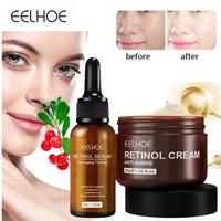 Gambar Eelhoe Retinol Cream + Retinol Serum Set Anti-Aging Penghilang Flek Hitam Di Wajah & Anti Aging Glowing Moisturizer Day Cream 30g dari Weloee undefined 5 Tokopedia
