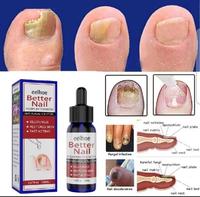 Gambar obat jamur kuku perawatan kuku obat kuku cantengan vitamin kuku dan kutikula emtrix untuk obat kuku rusak obat kuku jamur dan rusak jamur kuku obat paling ampuh pembersih kuku mengkilap pembersih kuku pemutih kuku  - M888 dari www.ABCstore.id undefined 2 Tokopedia