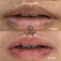 Gambar New* Pinky Secret Treatment For Ci Lia . dari Lamia26 undefined 2 Tokopedia