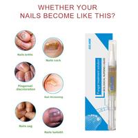 Gambar serum kuku jamur dan rusak Serum Nail Repair Essence Serum Serum Penghilang Jamur Di Kuku Rusak Repair Pen Penghilang Jamur Kuku Gel - 1pc dari QUNTELL undefined 2 Tokopedia