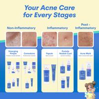 Gambar Emina Ms. Pimple Acne Solution Face Serum 30 mL - Serum Wajah Solusi Atasi Jerawat - 30 ml dari eminacosmetics undefined 5 Tokopedia