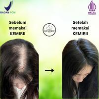 Gambar [BPOM] Kemiry Organic Minyak Kemiri Bakar Original Penumbuh Rambut Alis Asli Pria Brewok Penebal Perawatan Rontok Pelebat Jenggot Penghitam Hitam dari Kumala Dewi Official undefined 3 Tokopedia