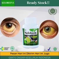 Gambar Penyakit Mata Kuning, Penghilang Mata Kuning, Mata Kuning, Liver Mata Kuning, Pemutih Sklera Mata Kuning - isi 50 kapsul dari Dyna Herbs undefined 1 Tokopedia