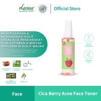 Gambar CICA BERRY ACNE FACE TONER - Face Toner Untuk Remaja Berjerawat - ACNE FACE TONER dari Larissaaestheticcenter undefined 1 Tokopedia
