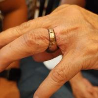 Gambar alat potong cincin di jari ST6 dari Core One Buy undefined 4 Tokopedia