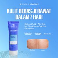 Gambar Emina Face Wash All Series - Niacinamide Oxy Ceramide Brightening Face Wash, Emina Prebiotic Tranexamic Acid Brightening, Ms Pimple Acne Solution, Oat Amino Low pH Cleanser - Sabun Cuci Muka, Mencerahkan, Mencegah Jerawat, Memperbaiki Skin Barrier, Low pH - Bright 100ml dari eminacosmetics undefined 3 Tokopedia