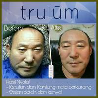 Gambar Krim Pemutih Wajah Bpom | Trulum Mengencangkan Wajah Dengan Cepat dari Trulum Asli undefined 5 Tokopedia