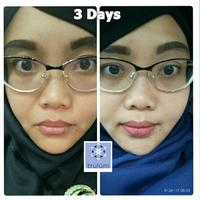 Gambar Penghilang Jerawat Pada Wajah | Pemutih Wajah Paling Cepat Dan Aman dari Cosme Garuda undefined 4 Tokopedia