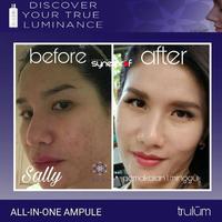 Gambar TRULUM BOPENG JERAWAT / CREAM BOPENG| PENGHILANG BOPENG AMPUH TERLARIS dari Trulum Asli undefined 4 Tokopedia