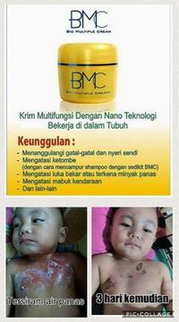 Gambar BMC BOTOL 60GR -NANO TECH- KRIM P3K-MELEPUH-LUKA BAKAR dari blesstoresurabaya undefined 2 Tokopedia