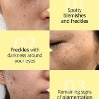 Gambar SOMEBYMI Some by Mi Me Paket Yuja Niacin Toner + Serum Whitening flek dari yujabeauty undefined 4 Tokopedia
