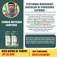 Gambar Obat benjolan dibawah dagu, benjolan di leher,di ketiak kiri dari Berkah Walatra Chanel undefined 4 Tokopedia