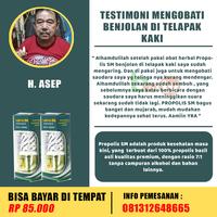 Gambar Obat benjolan dibawah dagu, benjolan di leher,di ketiak kiri dari Berkah Walatra Chanel undefined 2 Tokopedia